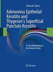 Tapa de Adenovirus Epithelial Keratitis and Thygeson's Superficial Punctate Keratitis