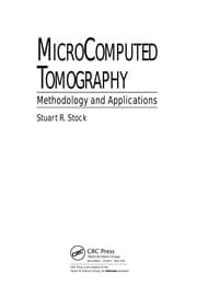 Tapa de MicroComputed Tomography