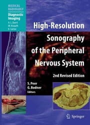 Tapa de High resolution sonography of the peripheral nervous system