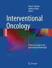 Tapa de Interventional oncology