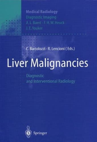 Tapa de Liver Malignancies