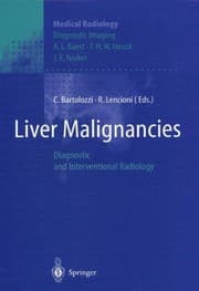 Tapa de Liver Malignancies
