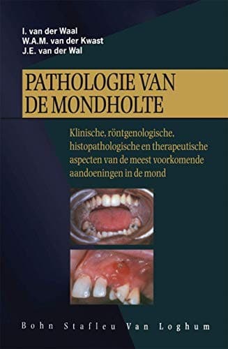 Tapa de Pathologie van de mondholte