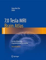 Tapa de 7.0 Tesla MRI Brain Atlas