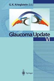 Tapa de Glaucoma Update Vi