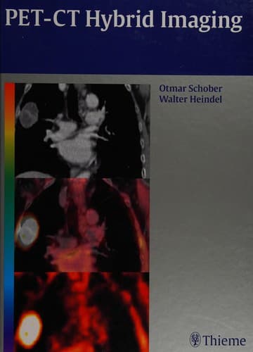 Tapa de PET-CT hybrid imaging