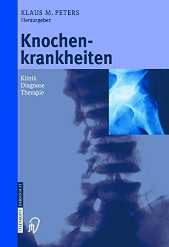 Tapa de Knochenkrankheiten