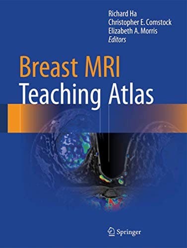 Tapa de Breast MRI Teaching Atlas