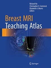 Tapa de Breast MRI Teaching Atlas