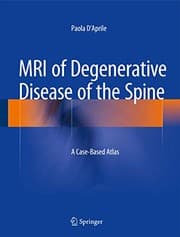 Tapa de MRI of Degenerative Disease of the Spine