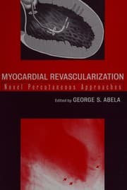 Tapa de Myocardial revascularization