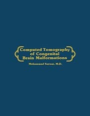 Tapa de Computed Tomography of Congenital Brain Malformations