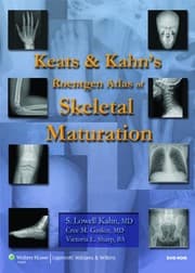 Tapa de Keats and Kahn's Roentgen Atlas of Skeletal Maturation