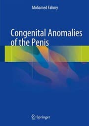 Tapa de Congenital Anomalies of the Penis