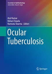 Tapa de Ocular Tuberculosis