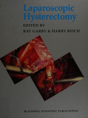 Tapa de Laparoscopic hysterectomy