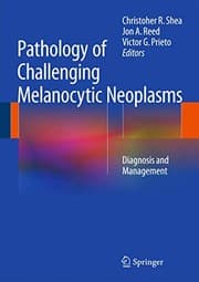 Tapa de Pathology of Challenging Melanocytic Neoplasms
