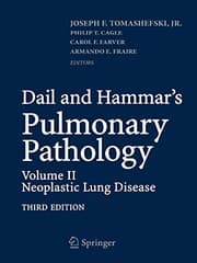 Tapa de Dail and Hammar's Pulmonary Pathology : Volume II