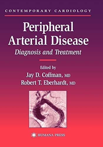 Tapa de Peripheral Arterial Disease