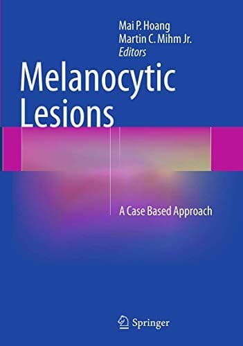 Tapa de Melanocytic Lesions