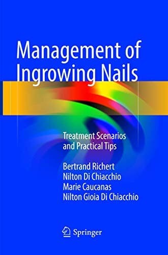 Tapa de Management of Ingrowing Nails