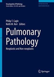Tapa de Pulmonary Pathology