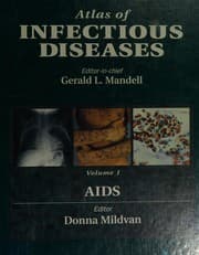 Tapa de AIDS