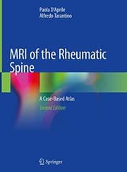 Tapa de MRI of the Rheumatic Spine