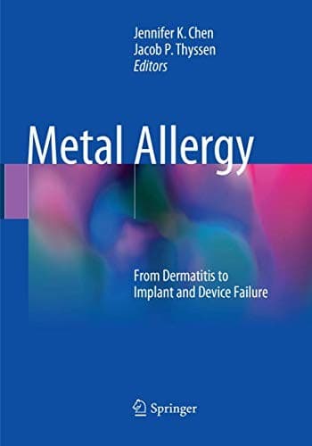 Tapa de Metal Allergy