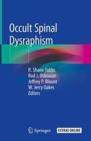 Tapa de Occult Spinal Dysraphism
