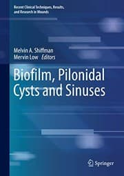 Tapa de Biofilm, Pilonidal Cysts and Sinuses