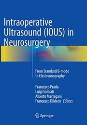 Tapa de Intraoperative Ultrasound  in Neurosurgery