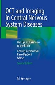 Tapa de OCT and Imaging in Central Nervous System Diseases