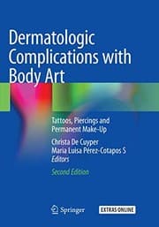 Tapa de Dermatologic Complications with Body Art