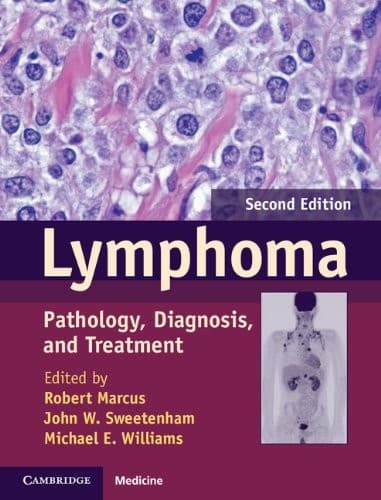 Tapa de Lymphoma