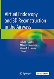 Tapa de Virtual Endoscopy and 3D Reconstruction in the Airways