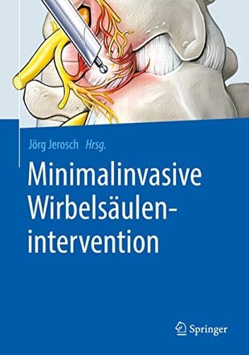 Tapa de Minimalinvasive Wirbelsäulenintervention