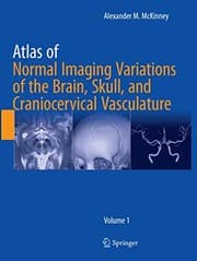 Tapa de Atlas of Normal Imaging Variations of the Brain, Skull, and Craniocervical Vasculature