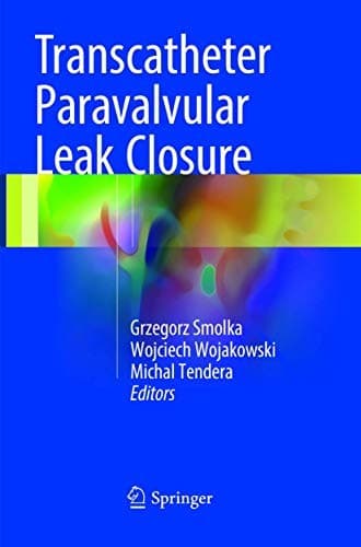 Tapa de Transcatheter Paravalvular Leak Closure