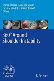 Tapa de 360° Around Shoulder Instability