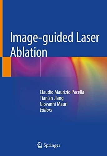 Tapa de Image-guided Laser Ablation
