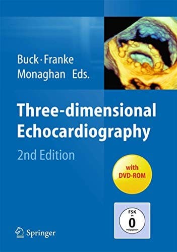 Tapa de Three-dimensional Echocardiography
