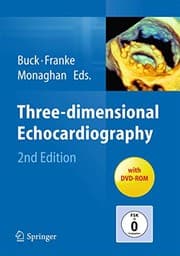 Tapa de Three-dimensional Echocardiography