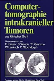 Tapa de Computertomographie intrakranieller Tumoren aus klinischer Sicht