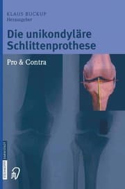 Tapa de Die unikondyläre Schlittenprothese Pro & Contra