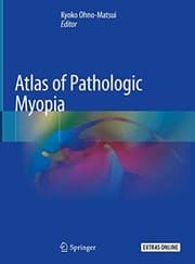 Tapa de Atlas of Pathologic Myopia