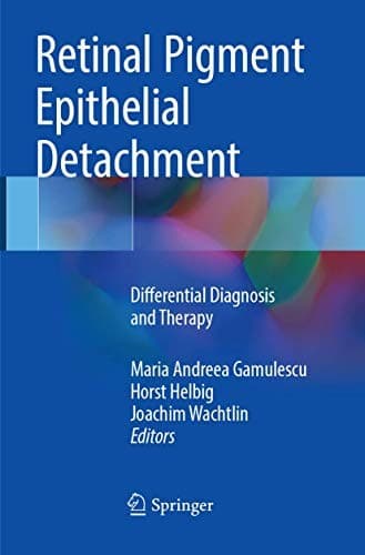 Tapa de Retinal Pigment Epithelial Detachment