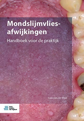 Tapa de Mondslijmvliesafwijkingen