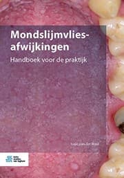 Tapa de Mondslijmvliesafwijkingen