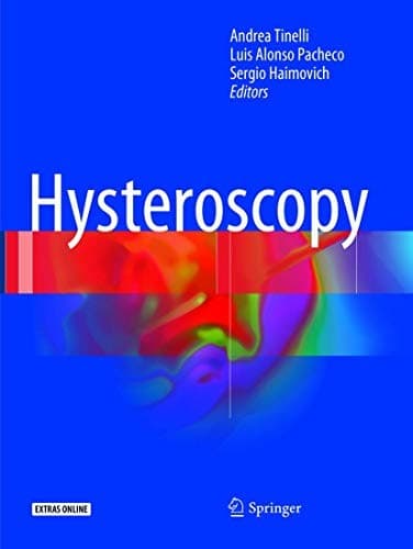 Tapa de Hysteroscopy